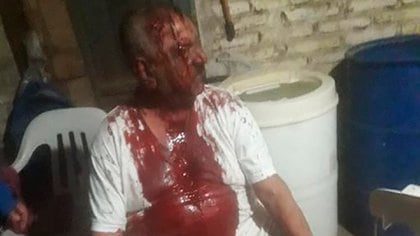 Horacio López terminó con la remera llena de sangre tras el ataque y robo