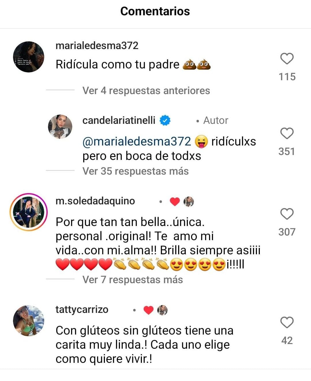 Cande Tinelli comentarios