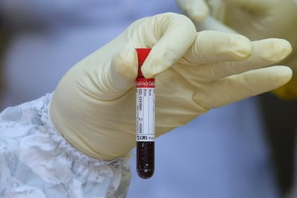 Los resultados principales sugieren que las personas con los tipos de sangre A, B o AB pueden ser más susceptibles a infectarse de COVID-19 que las personas con el tipo de sangre 0. (EFE/EPA/CHAMILA KARUNARATHNE/Archivo)  