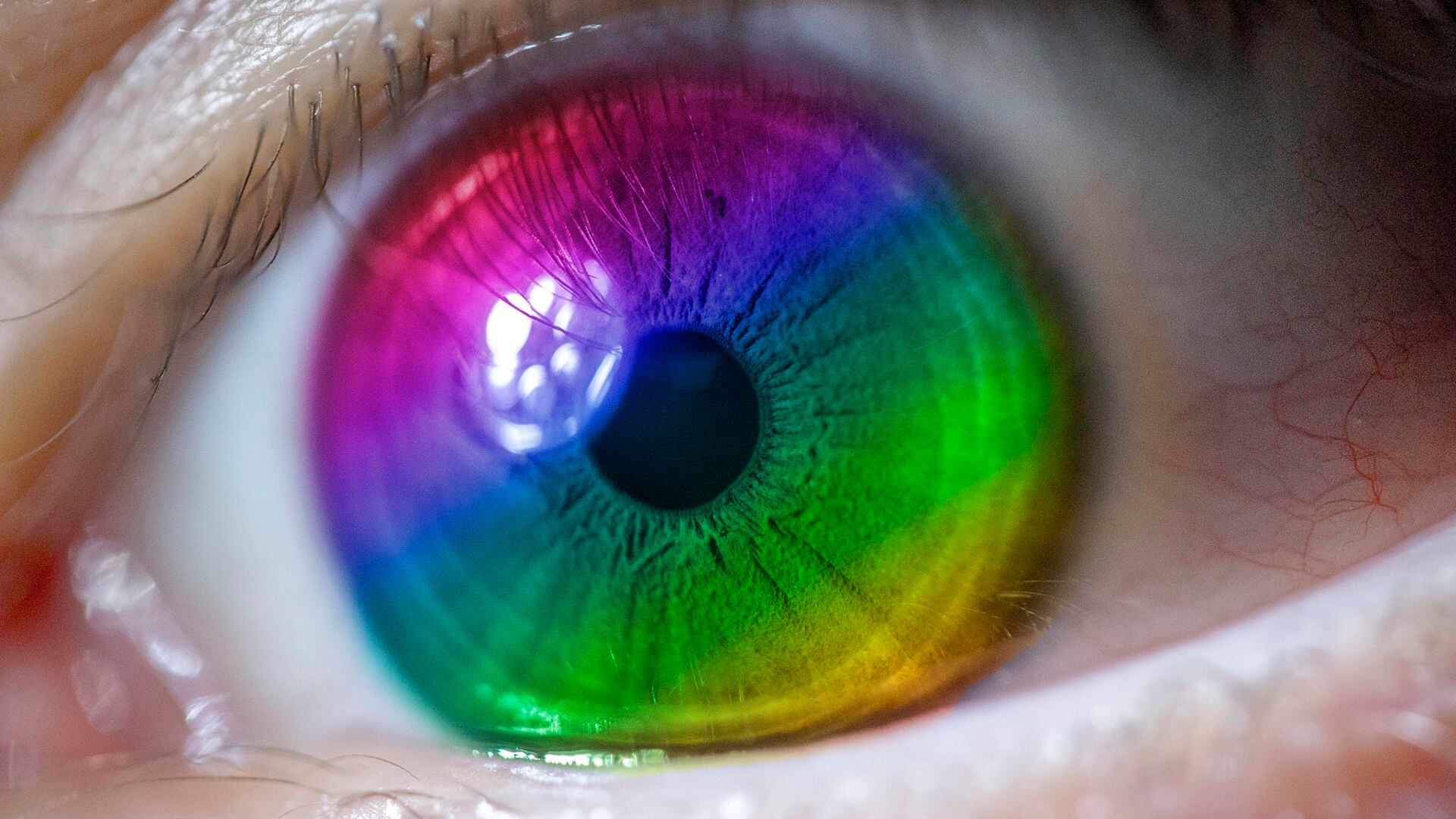 Esta condición, que consiste en la pérdida visual de un ojo, también se conoce como “ojo perezoso”
(iStock)