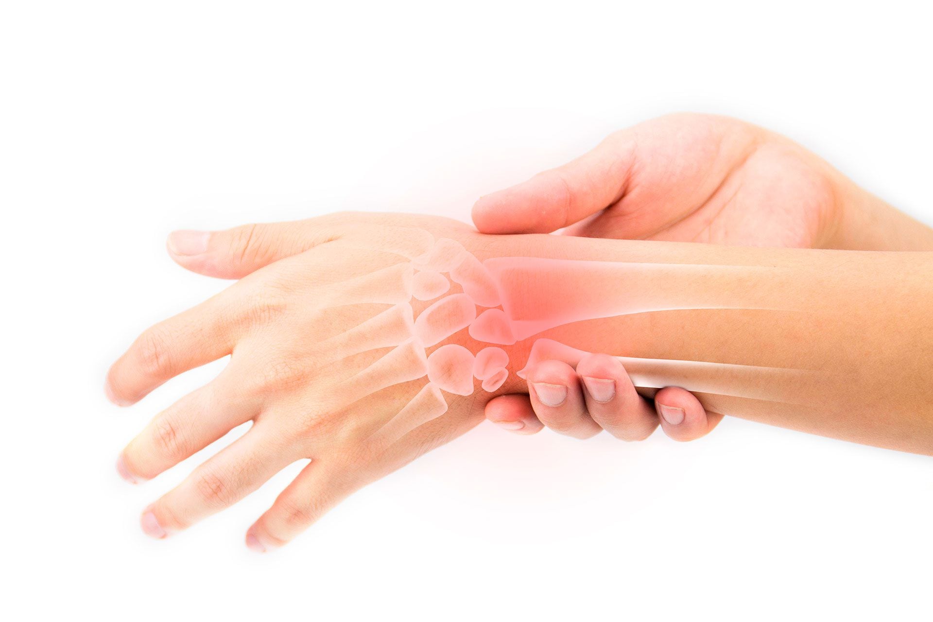 El 12 de octubre es el Día Mundial de la Artritis Reumatoidea (Shutterstock)