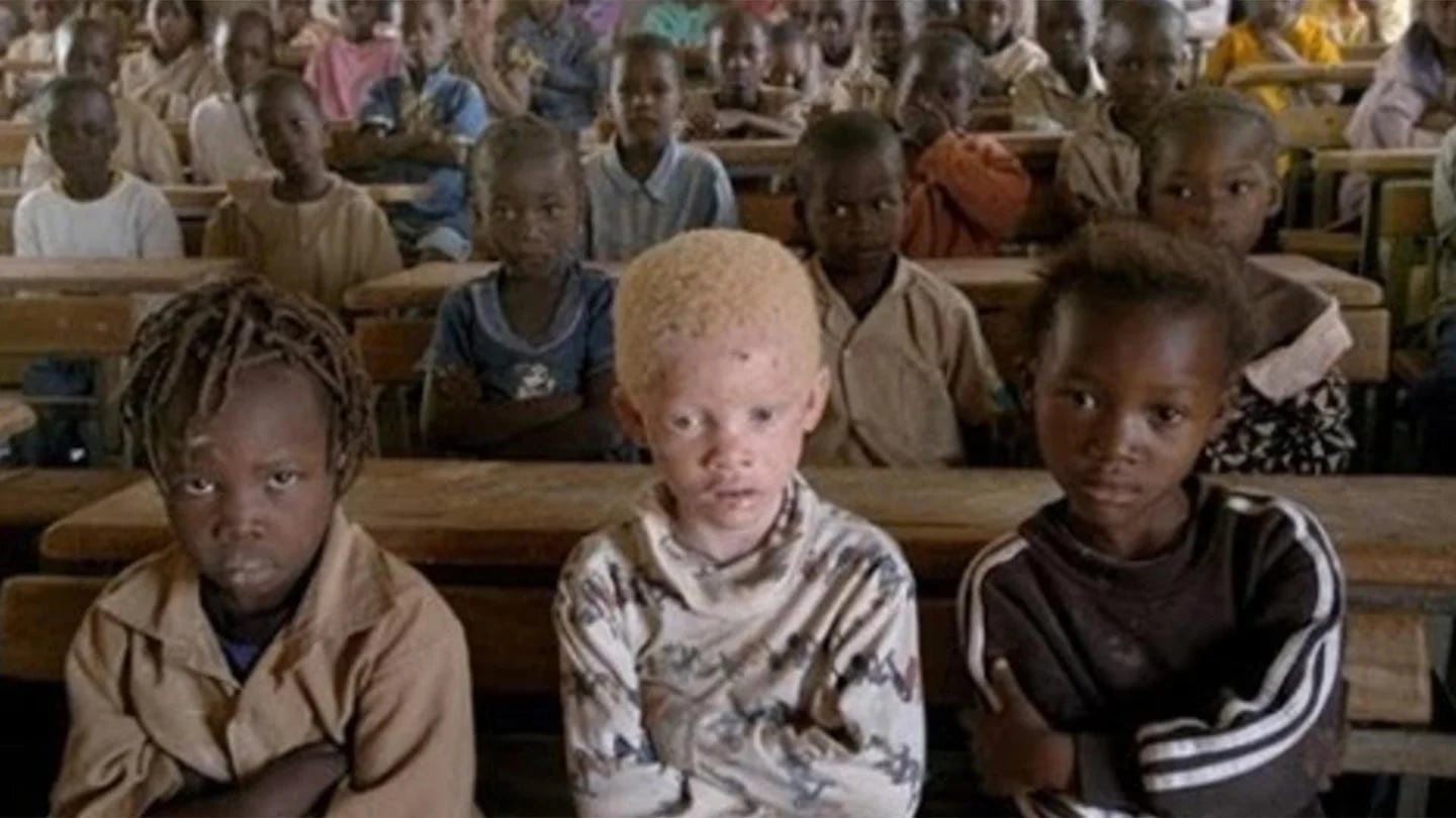 modelo albino africano