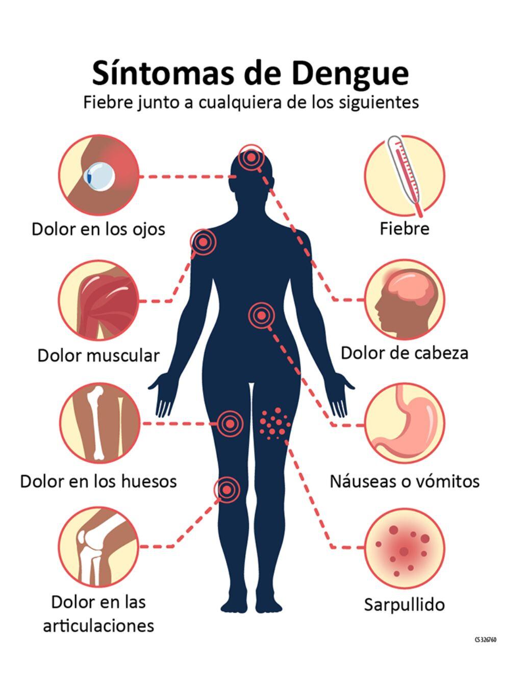 Infografía