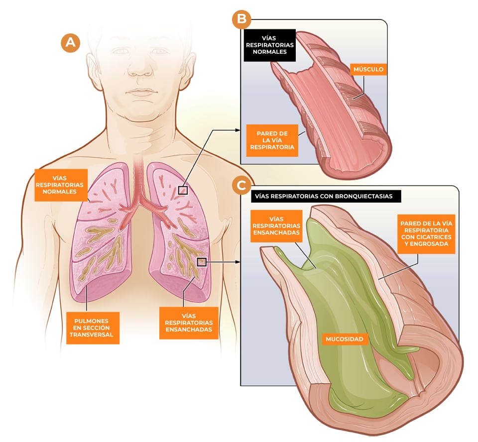 infografia