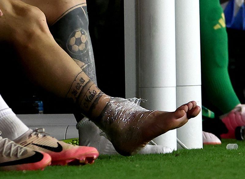 El tobillo del capitan de Argentina Lionel Messi tras salir lesionado (Reuters) 
