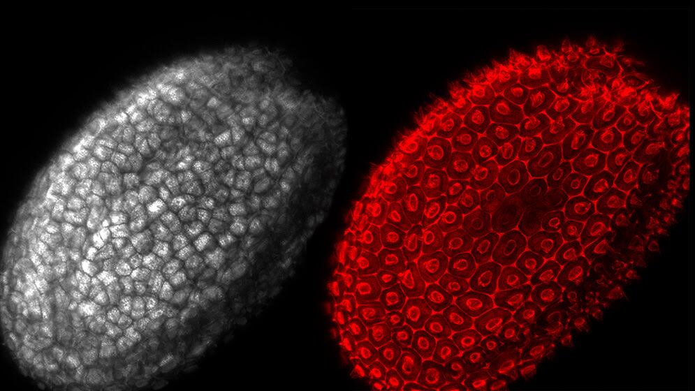 Semilla normal de A. thaliana bajo microscopio confocal