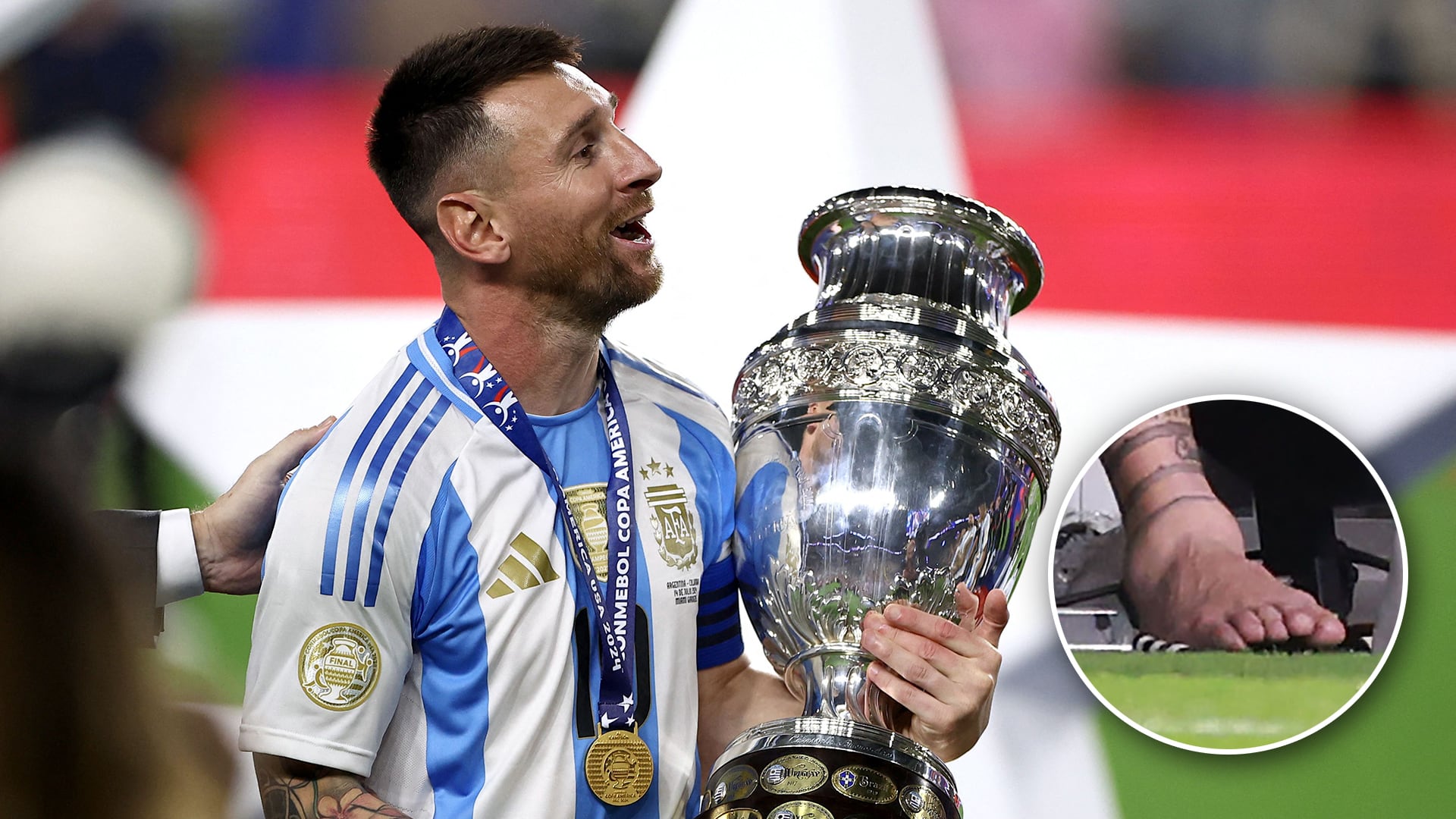 Messi y la Copa y en un circulito, el tobillo maltrecho