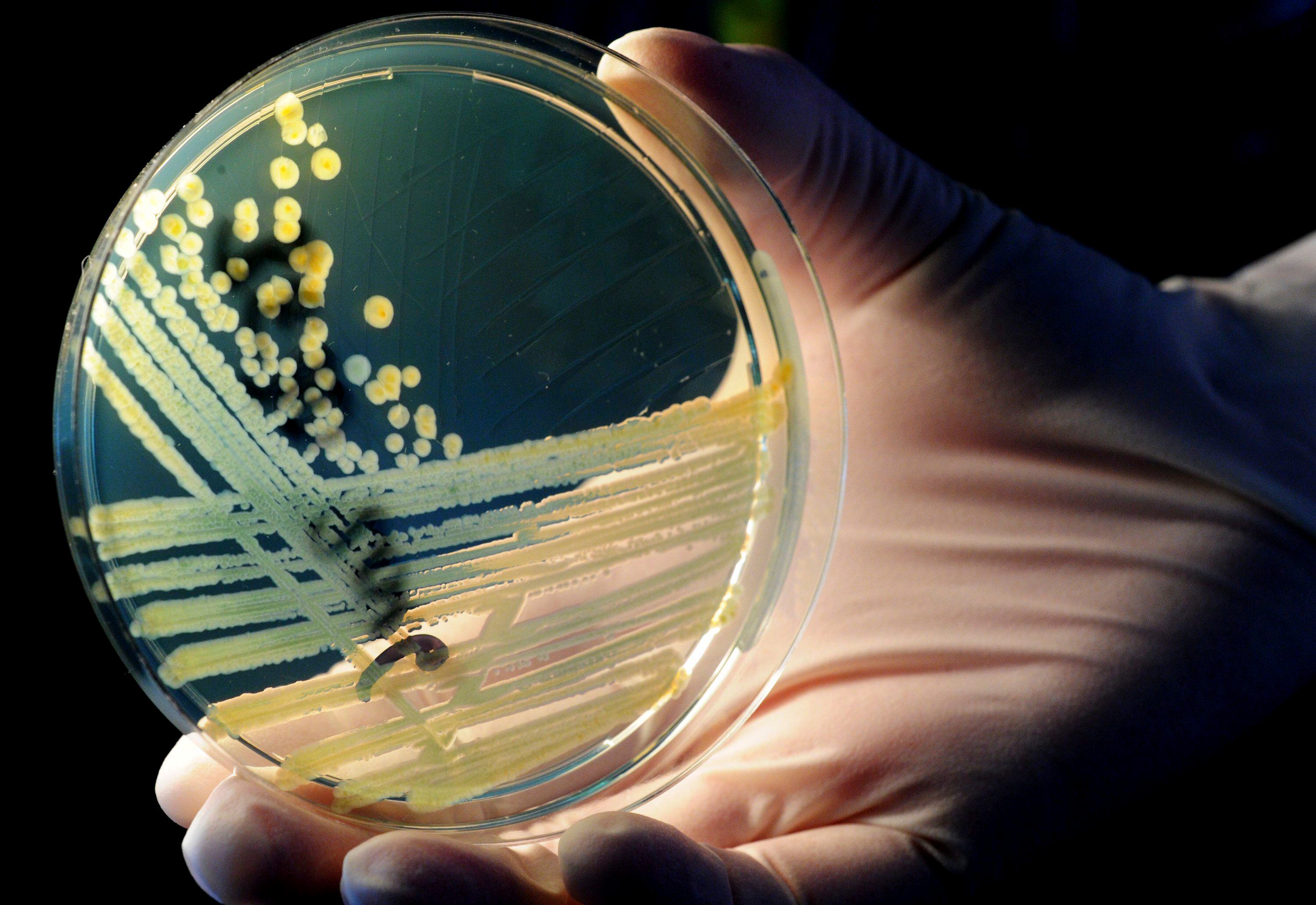 Los expertos identificaron 13 cepas de la superbacteria en distintos habitáculos del laboratorio orbital (EPA/Julian Stratenschulte) 