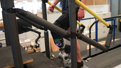 Una pierna biónica controlada por el cerebro ayuda a los amputados a caminar más rápido