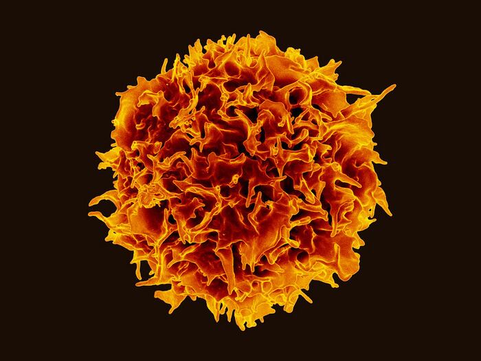 Colorized scanning electron micrograph of a CD4+ T-cell  CREDIT NIAID