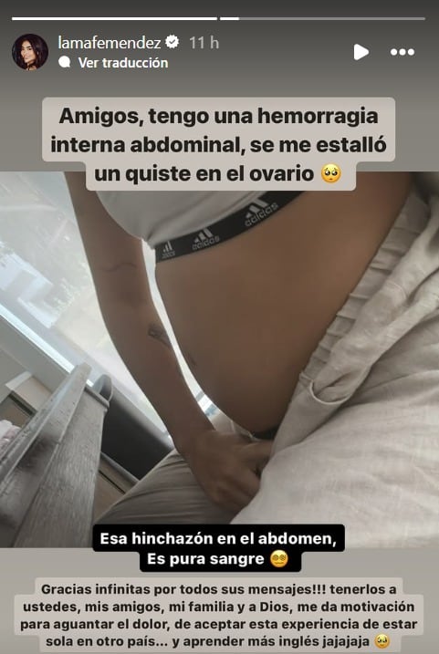 Mafe Méndez tuvo que ir al médico en Estados Unidos por un quiste que se le estalló en el ovario - crédito @lamafemendez/IG