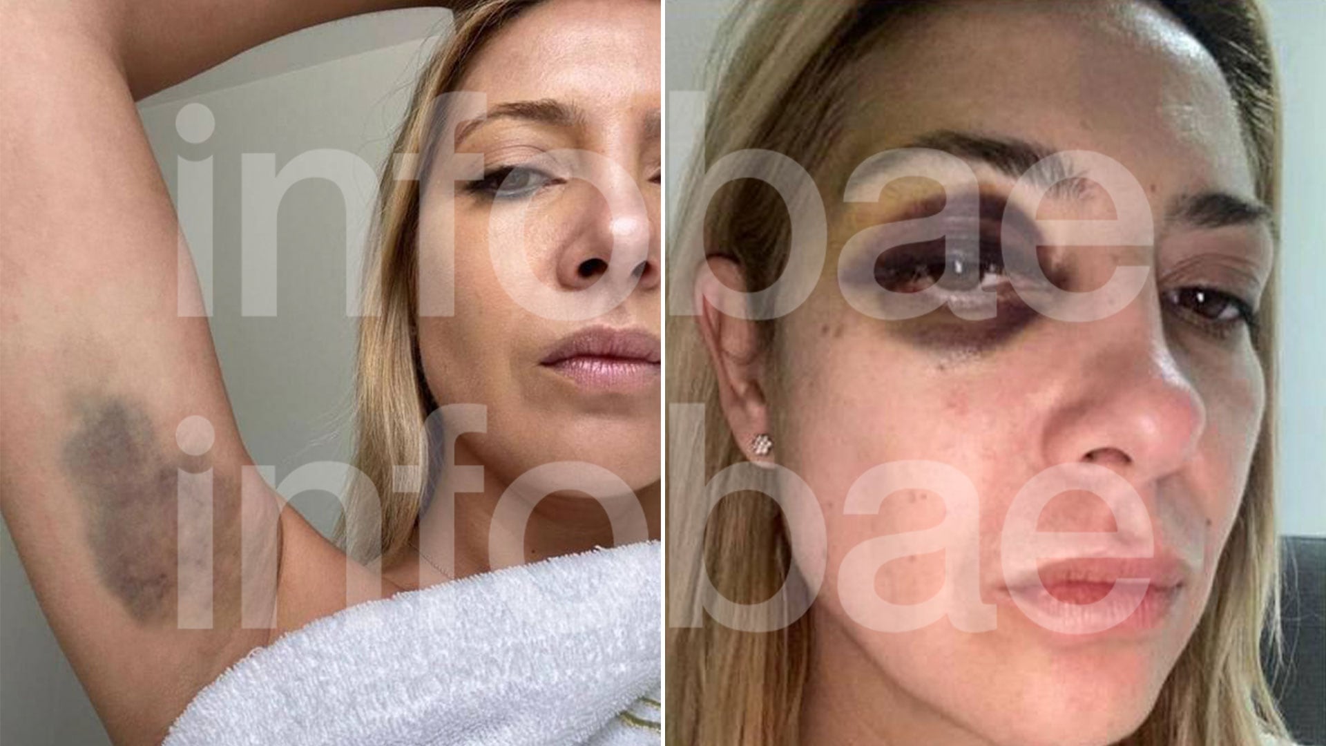 fotos chats fabiola yañez alberto fernandez violencia de genero golpes