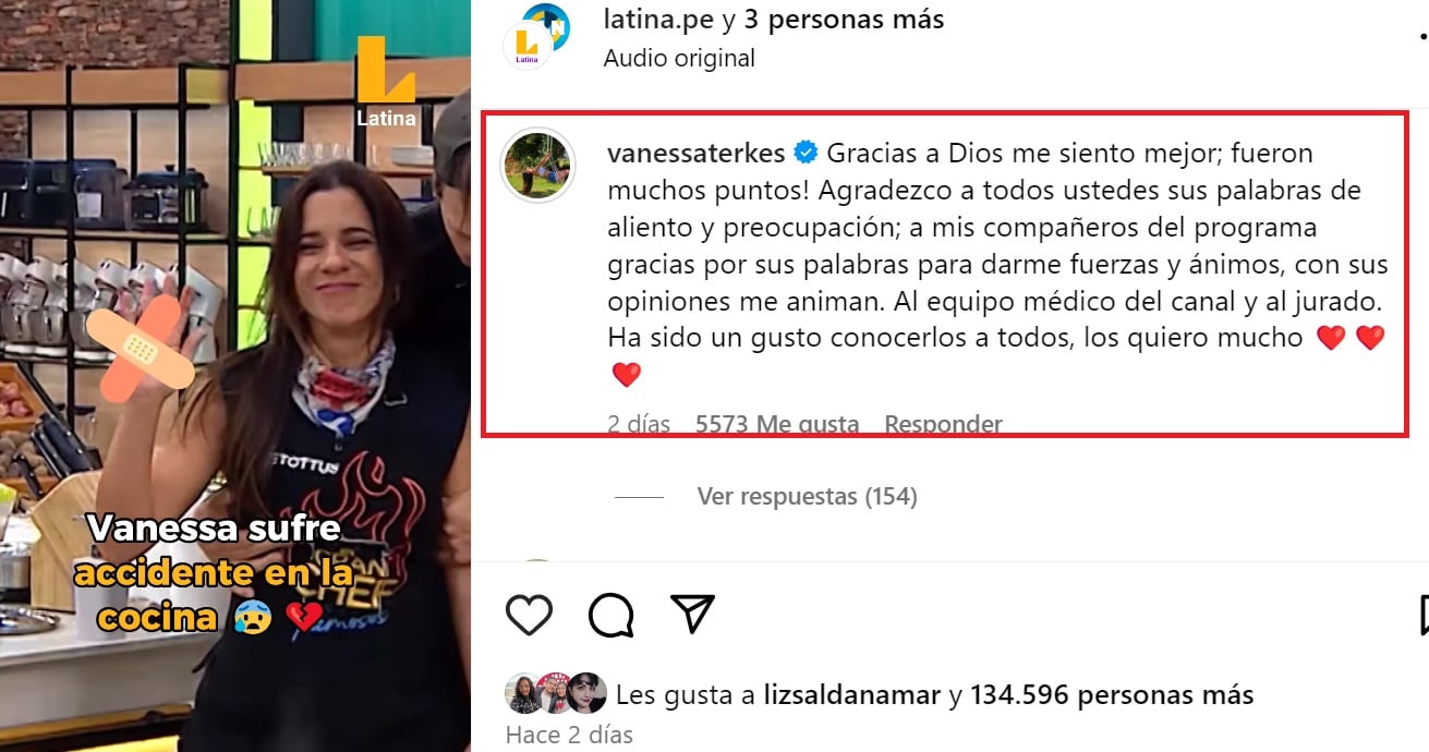 Vanessa Terkes cuenta cómo se encuentra tras duro golpe. IG