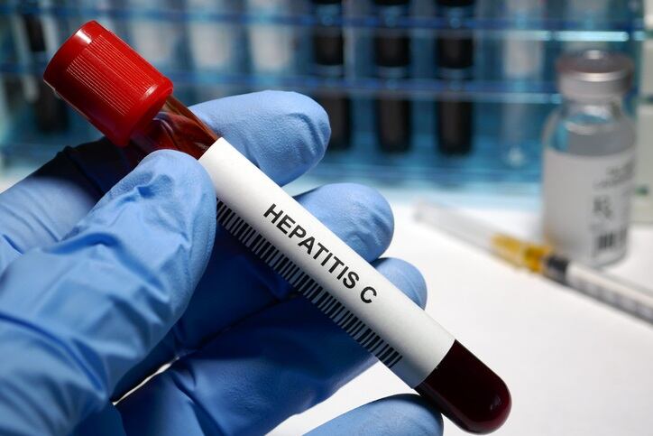 Aún hay millones de personas que tienen el virus de la hepatitis C y no lo saben (Europa Press) 