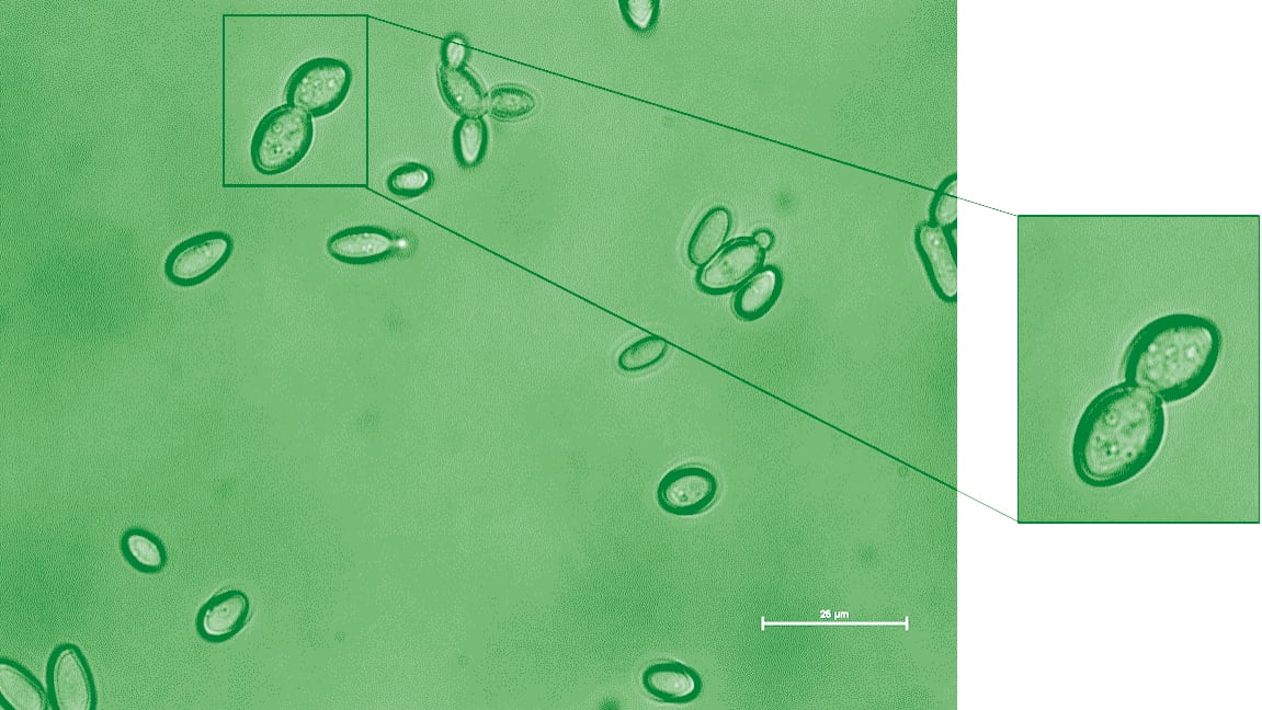 Kazachstania weizmannii, vista bajo el microscopio (Instituto Weizmann)