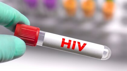 Día Nacional de la Prueba de VIH: los detalles de la jornada de testeo gratuito en Buenos Aires
