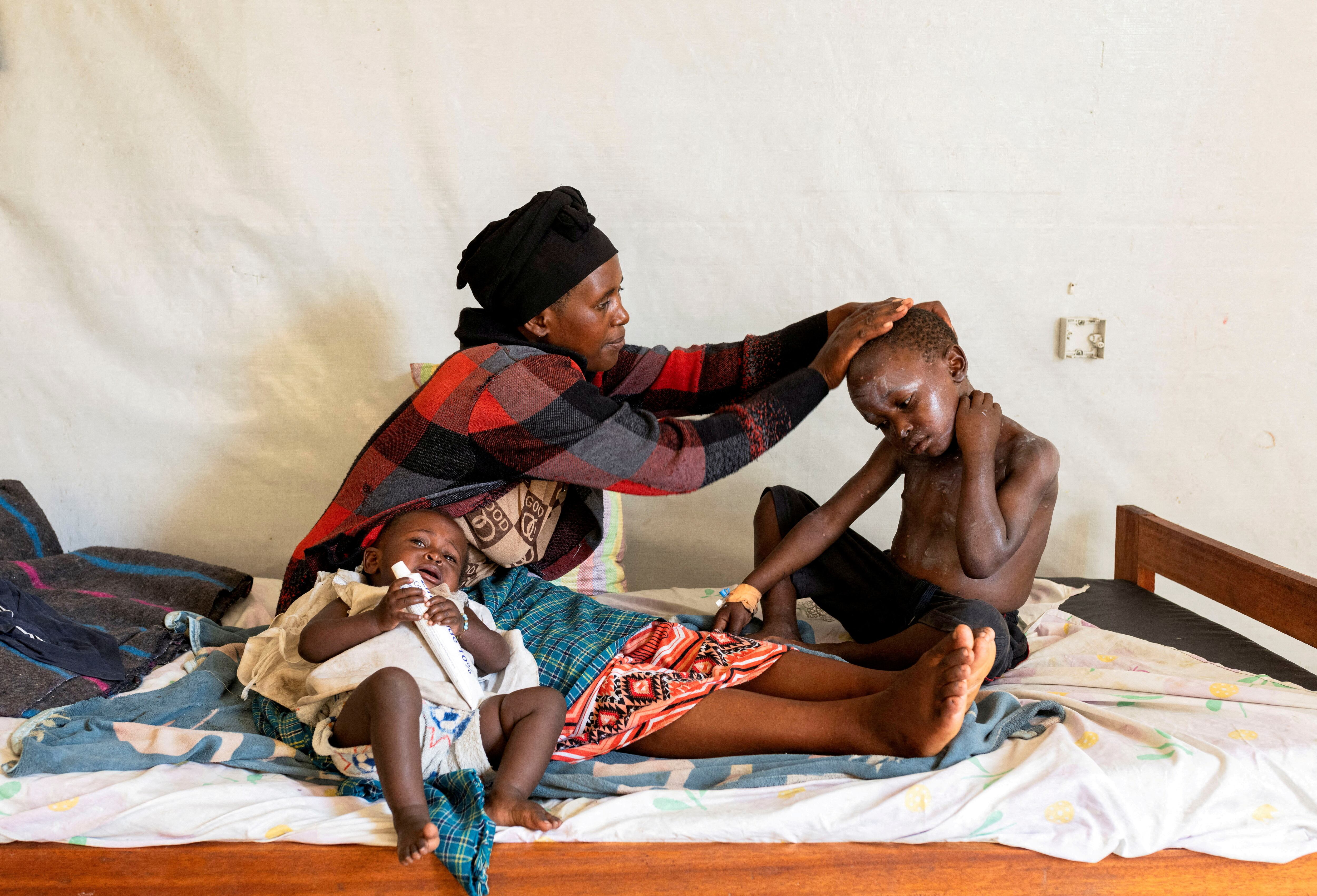 Elisabeth Furaha aplica la medicación en la piel de su hijo Sagesse Hakizimana que está bajo tratamiento para Mpox en un centro de salud en Munigi, República Democrática del Congo (REUTERS/Arlette Bashizi/Fotografía de archivo)