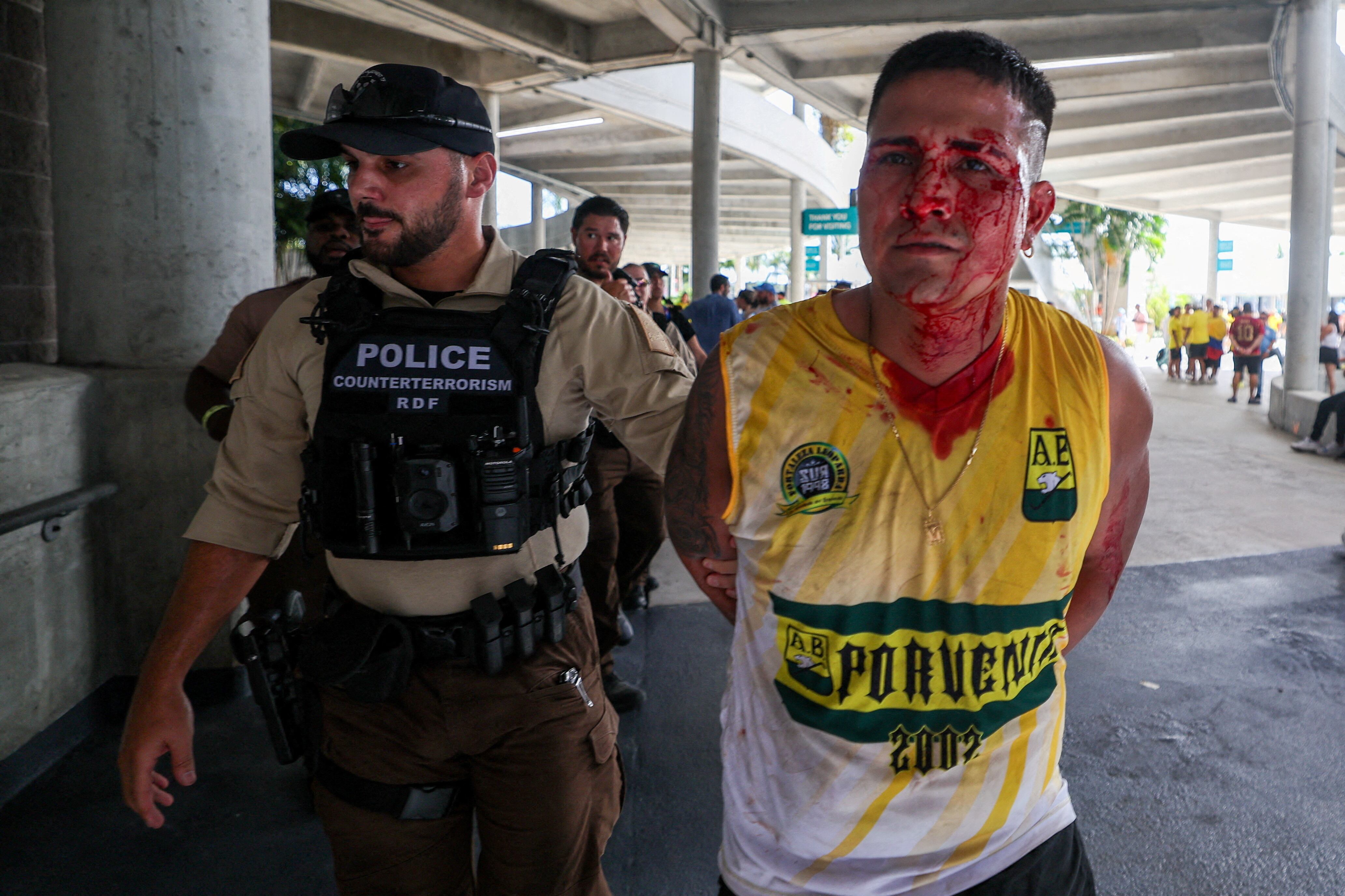 Policía de Miami detuvo a un colombiano que intentó ingresar al estadio por la fuerza- crédito: Nathan Ray Seebeck