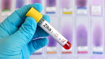 Descubren cómo el virus zika causa infección: usa al sistema inmune a su favor