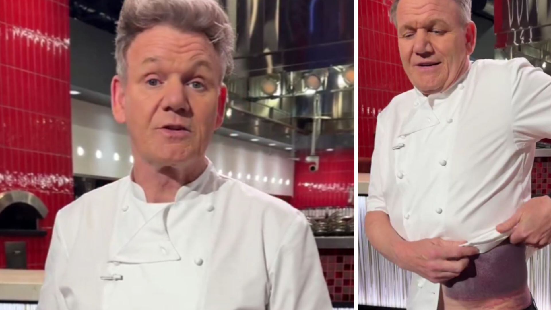 Gordon Ramsay, accidente en bicicleta