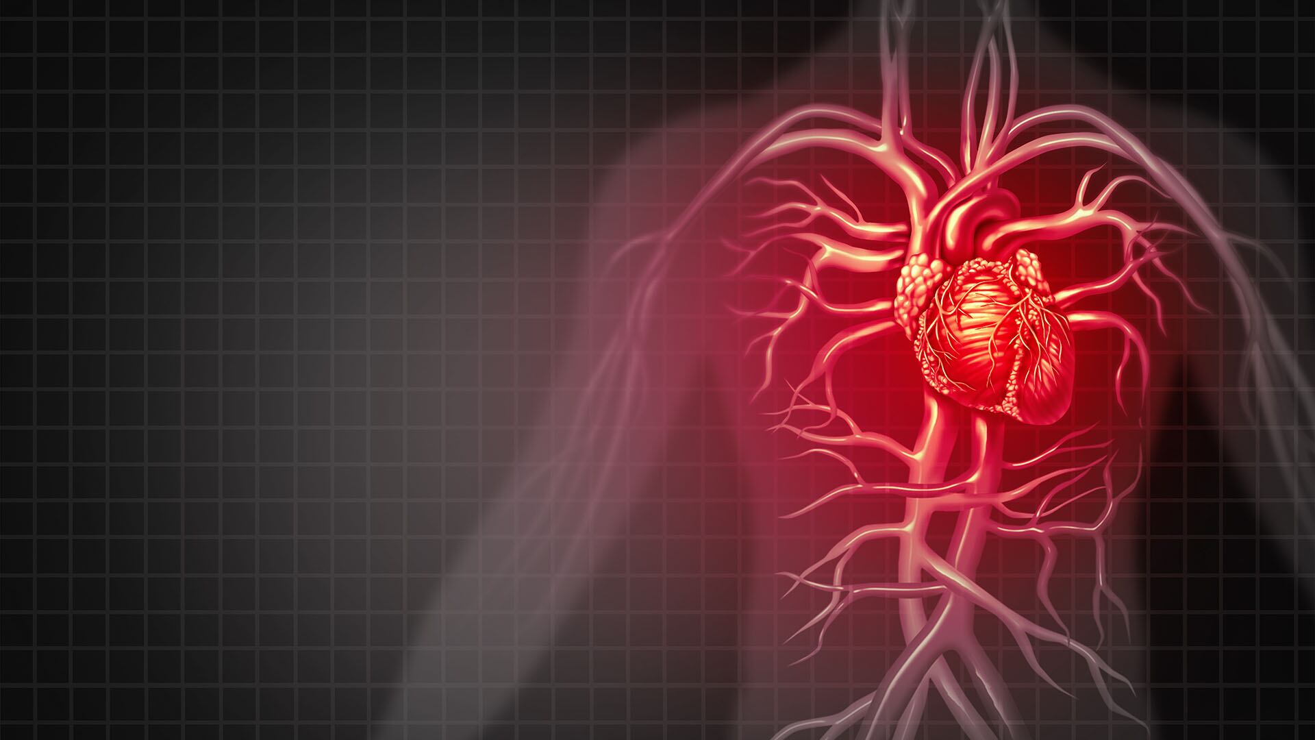 Los pacientes con antecedentes de eventos cardiovasculares tienen una tasa de mortalidad del 5 al 7%