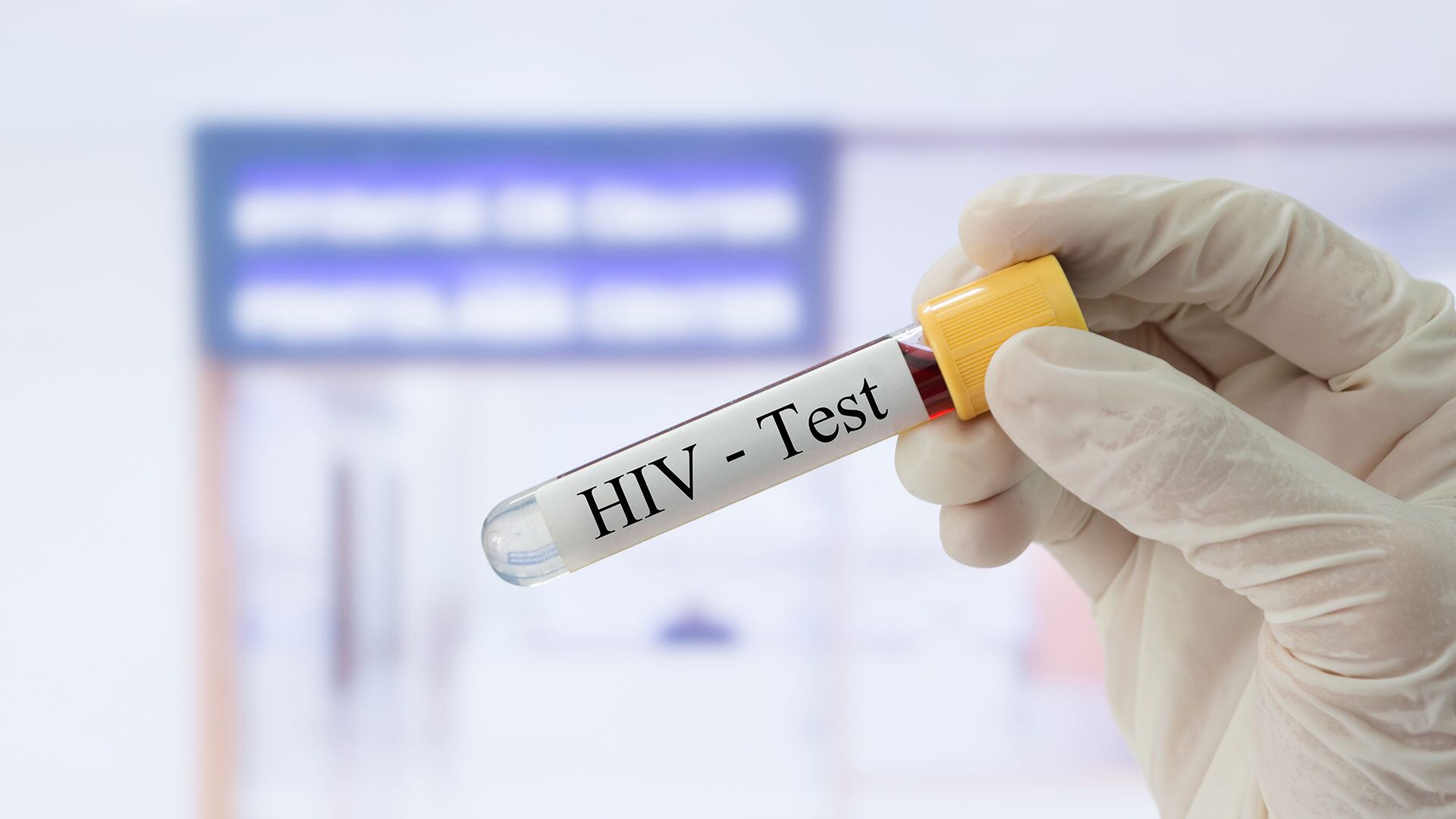 Para detectar el VIH, el test es un análisis de sangre simple (Getty)