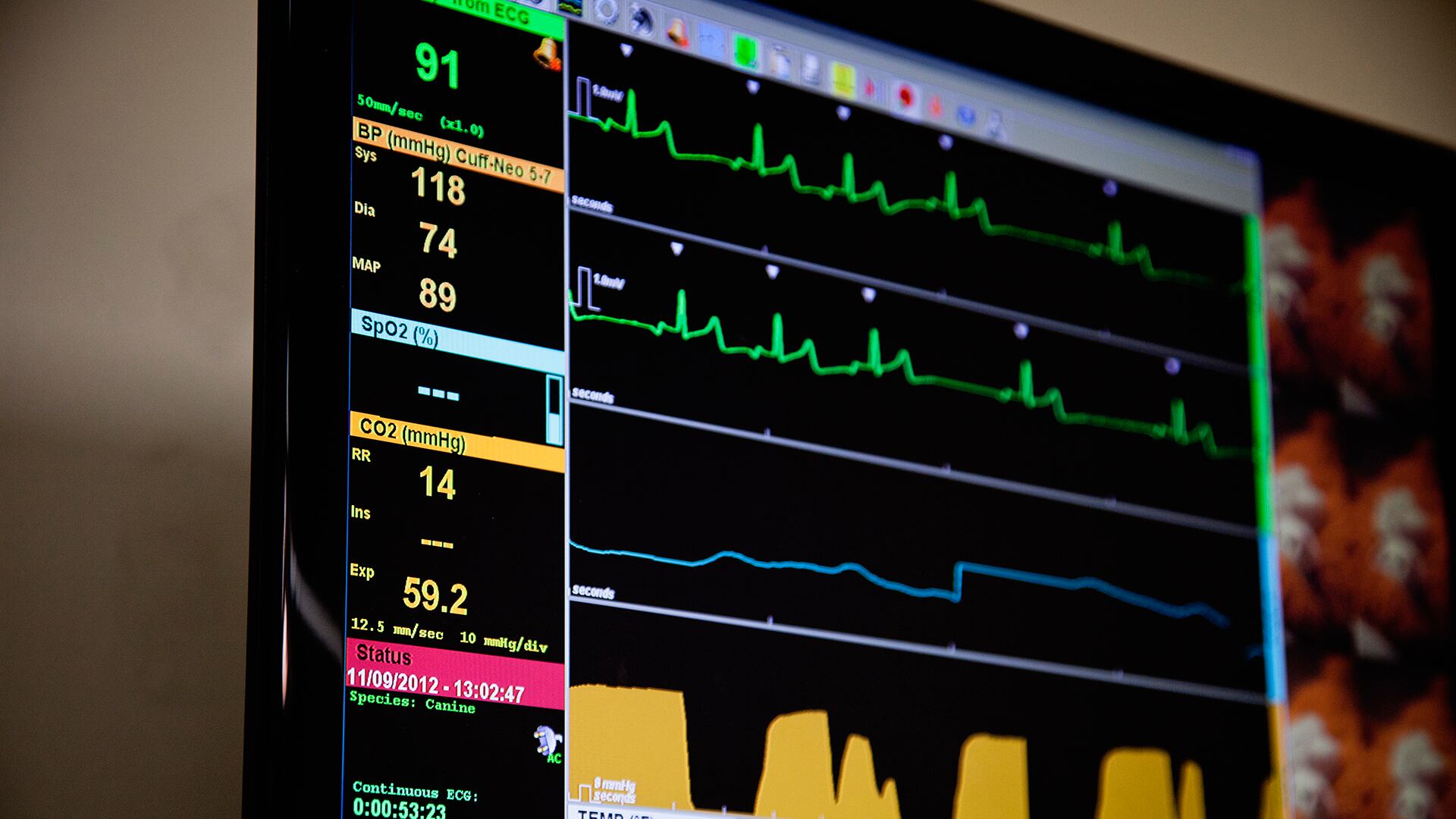 electrocardiograma