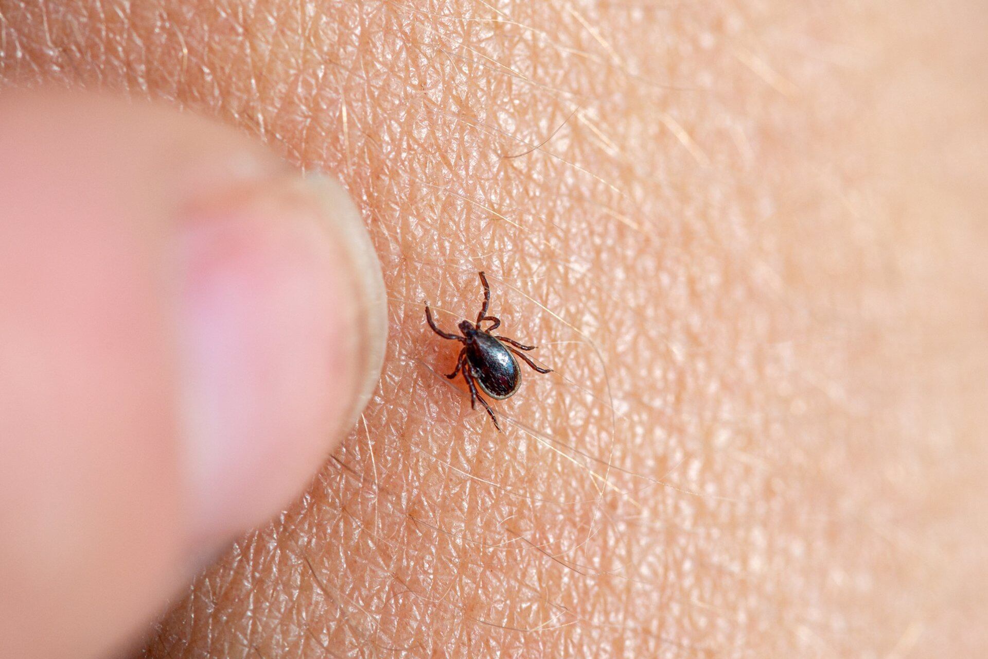 La enfermedad de Lyme tiene estos síntomas
SALUD 
FUNDACIÓN SOS LYME
