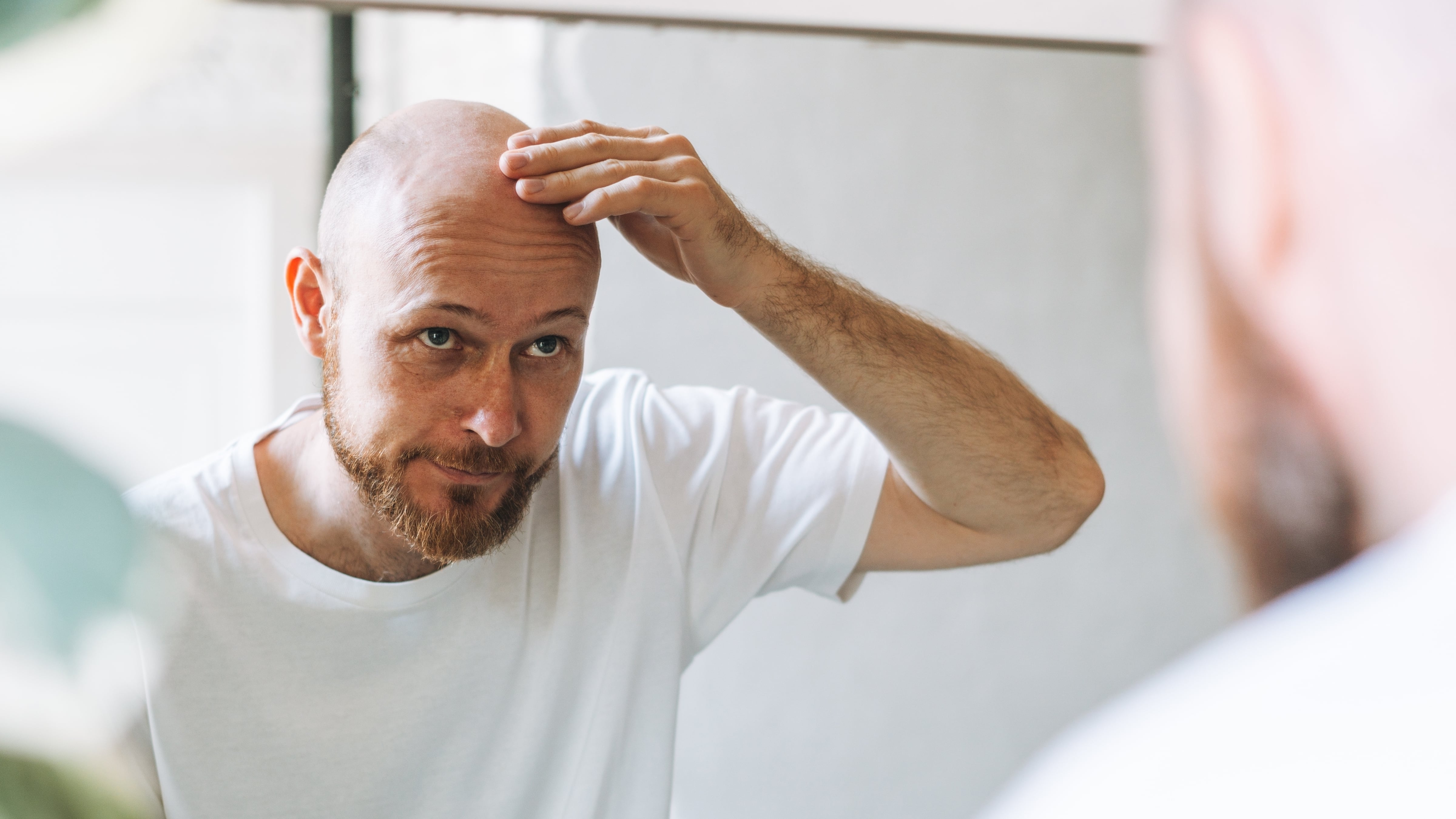 Hombre calvo mirándose al espejo (Shutterstock)