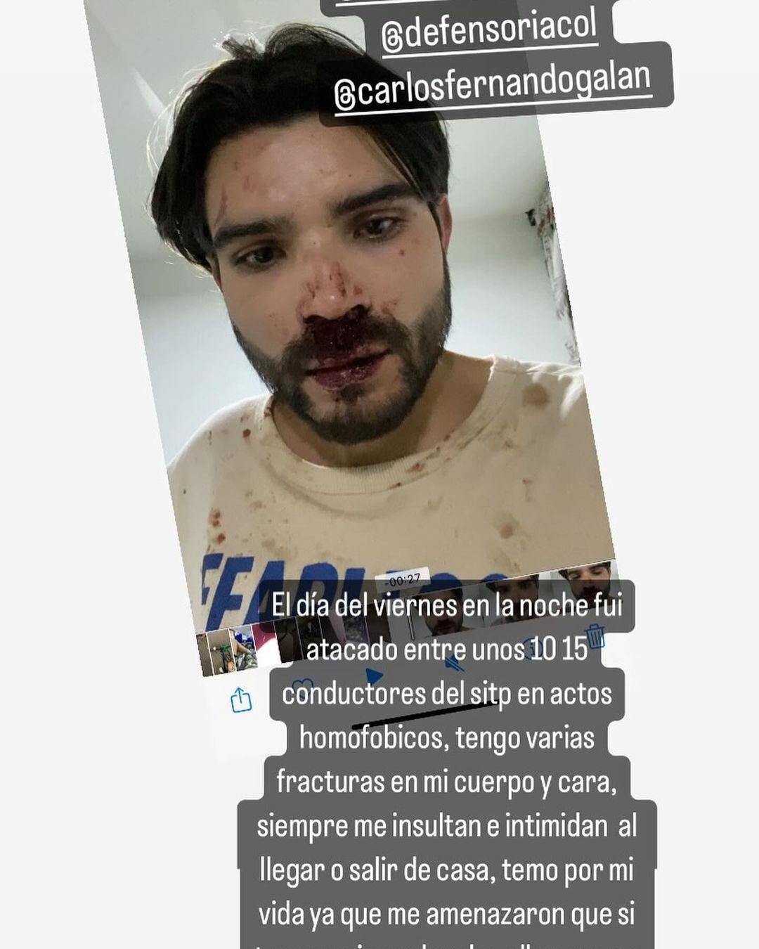 A través de redes sociales el joven contó detalles de lo sucedido - crédito edwardrdriguez/Instagram