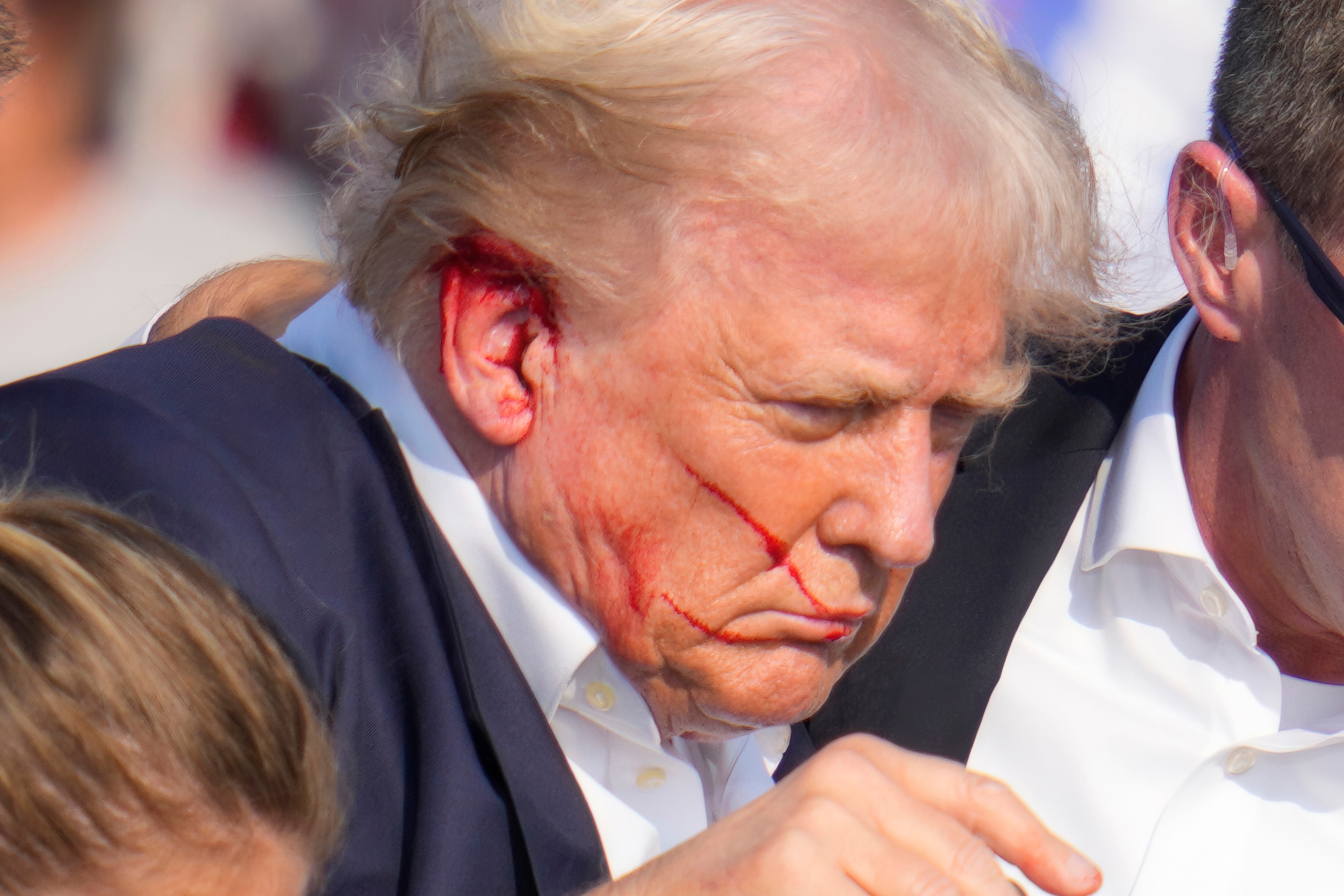 Trump sufrió una herida en su oreja derecha (AP Foto/Gene J. Puskar)