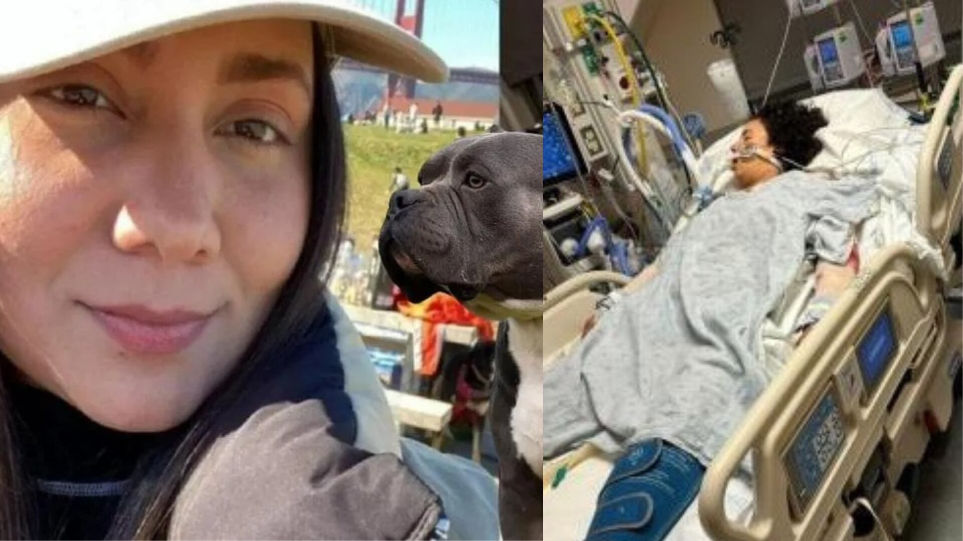 María Paula Contreras, la joven que fue atacada por dos perros - crédito redes sociales/X