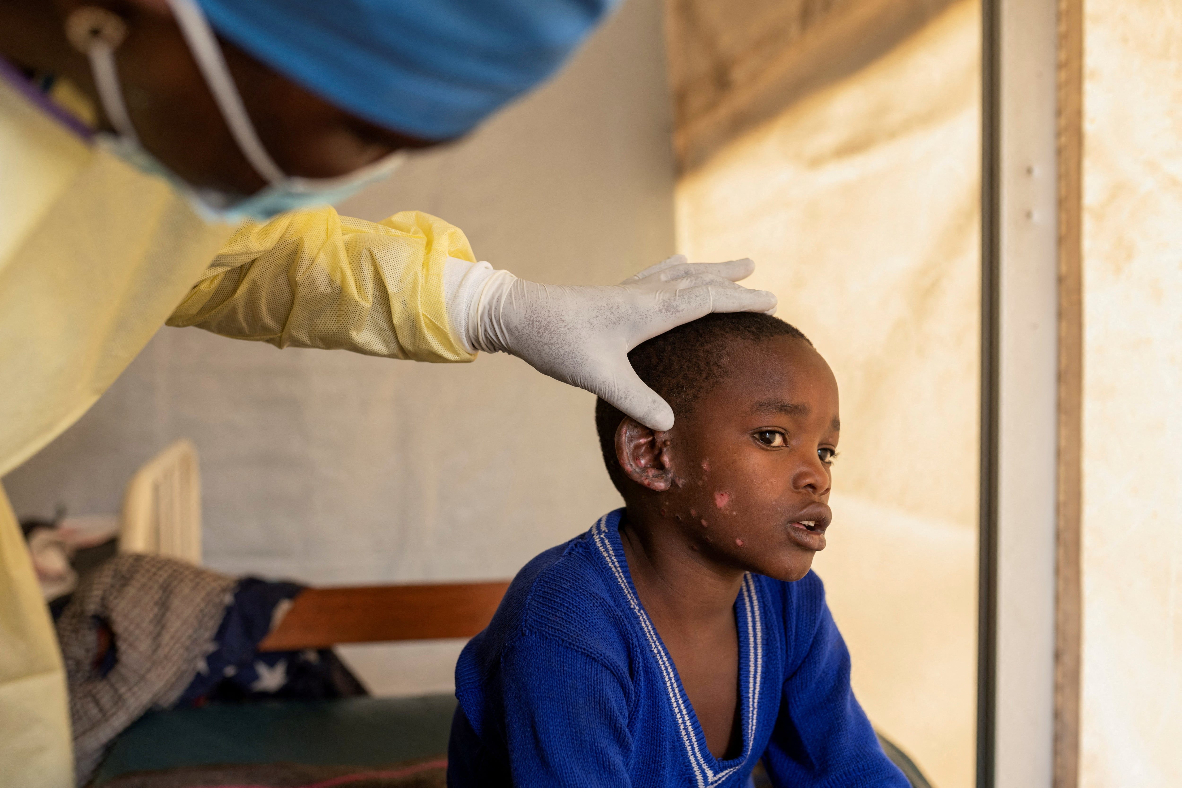 Un médico registra a un menor con síntomas en la localiad de Goma, en República del Congo el 19 de julio (REUTERS/Arlette Bashizi)