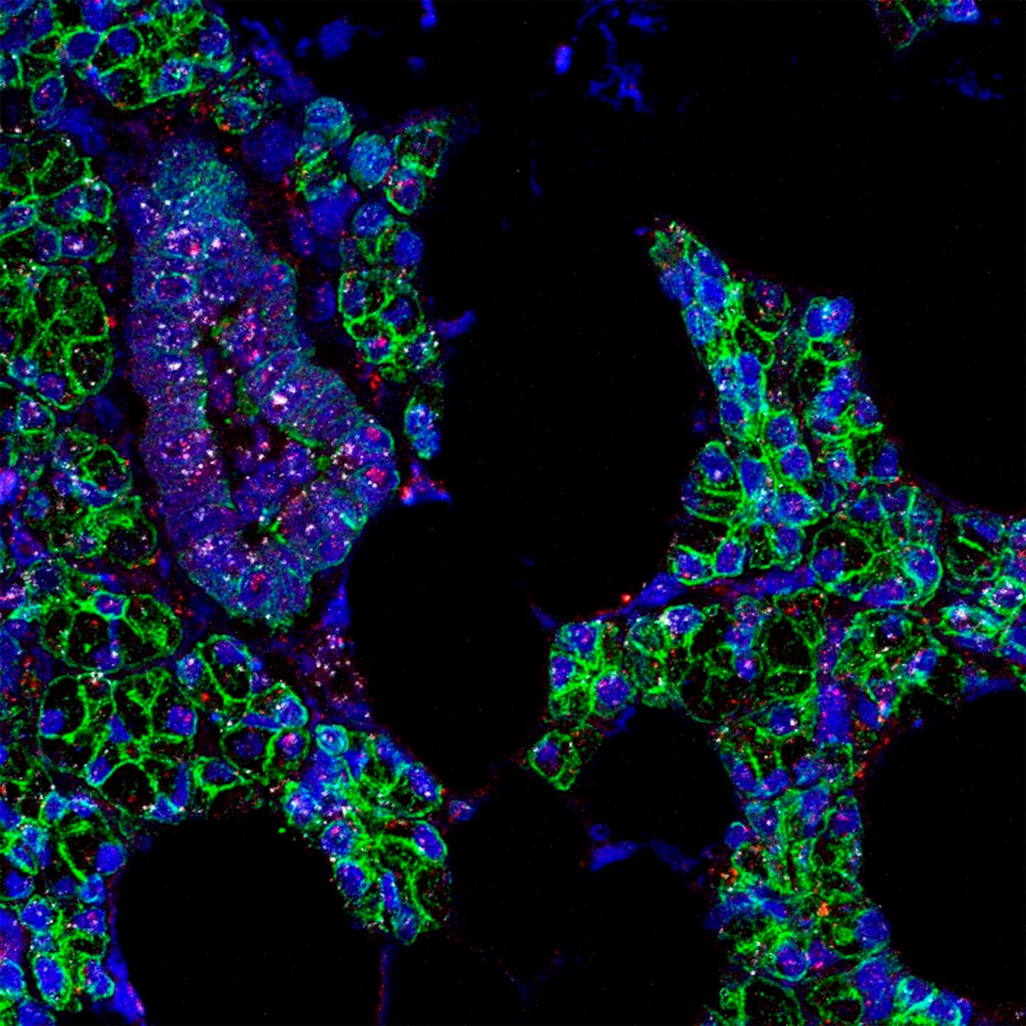 El ARN del SARS-CoV-2 (rosa) y del receptor ACE2 (blanco) encontrados en las células de las glándulas salivales humanas, que se han señalado en verde. (EFE/Paola Perez) 