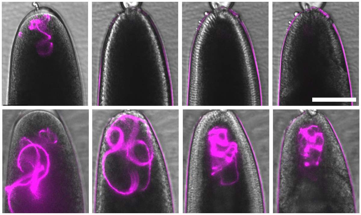 Las mitocondrias paternas de una mosca de la fruta (magenta) son claramente visibles en el huevo varios minutos después de su puesta (arriba a la izquierda), pero se destruyen por completo en una hora (arriba, segunda desde la izquierda).  Instituto Weizmann de Ciencias