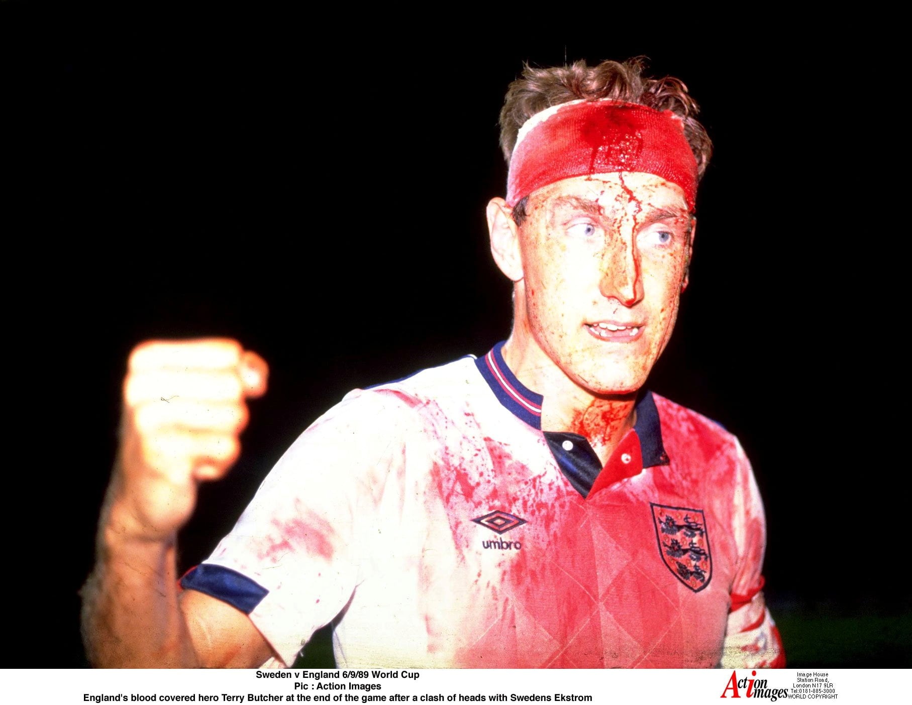 Terry Butcher cubierto en sangre tras un partido de la selección de Inglaterra ante Suecia (File Photo)