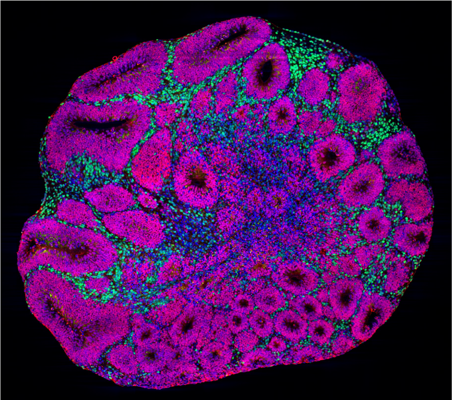 CAPTION Microscopy image of a brain organoid showing neuron precursors (magenta) and deep-layer projection neurons (green), which are one of the cell types affected by autism risk gene mutations.  CREDIT Paola Arlotta laboratory at Harvard University and Kwanghun Chung laboratory at MIT.