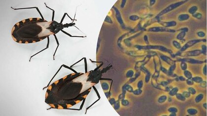 Qué es el Chagas, la enfermedad infecciosa potencialmente mortal que se puede transmitir de madre a hijo y que preocupa a Sanidad