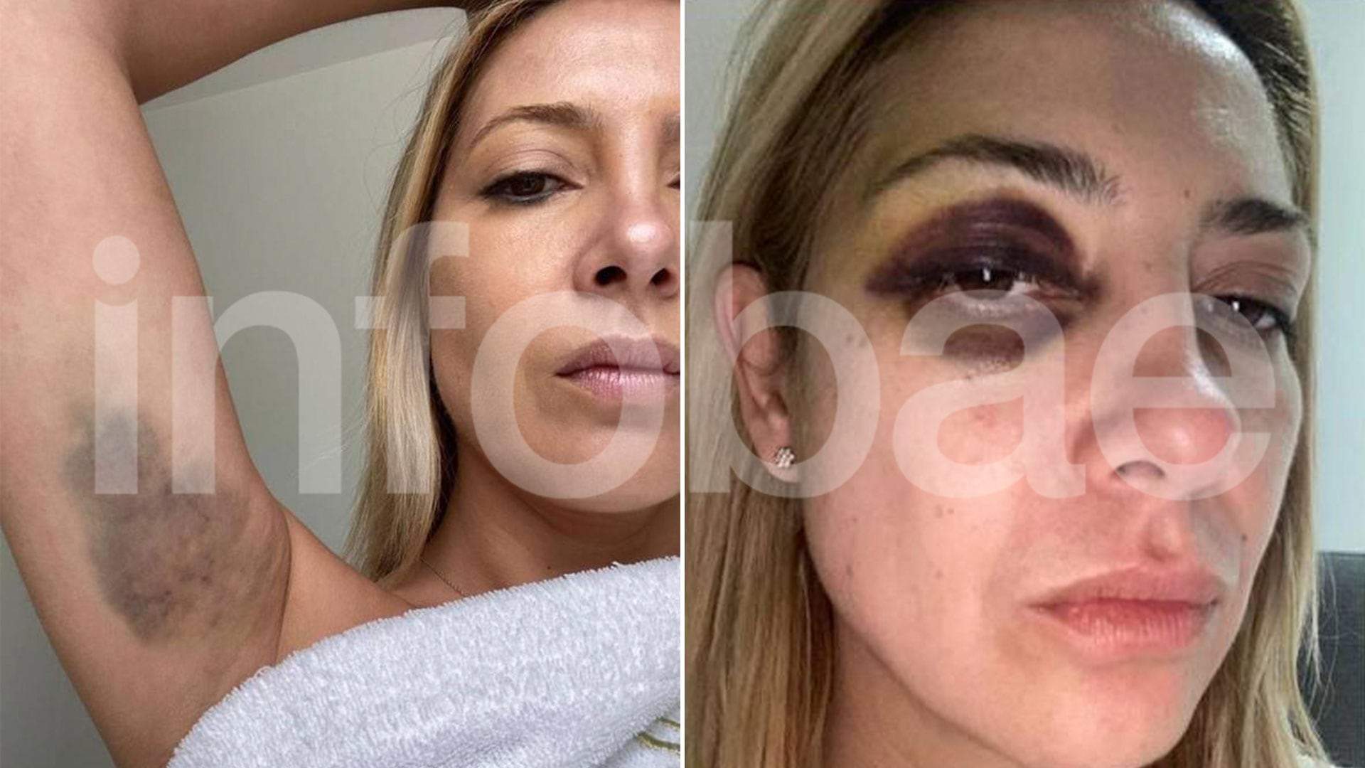 fotos chats fabiola yañez alberto fernandez violencia de genero golpes